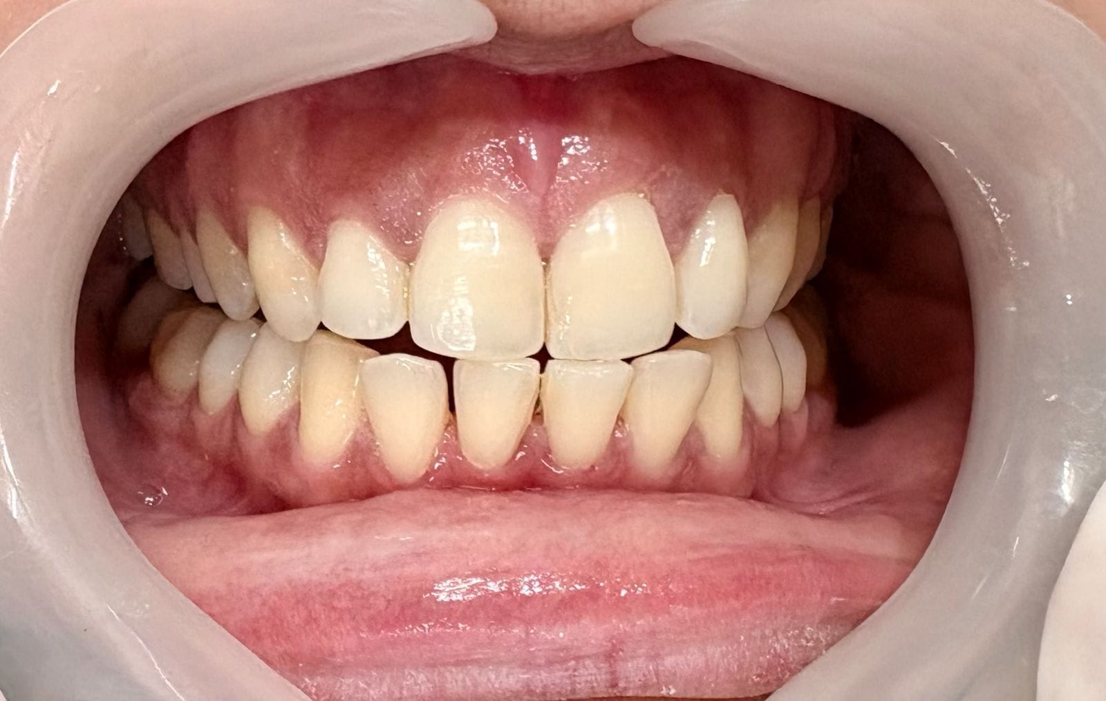 Dental treatment after