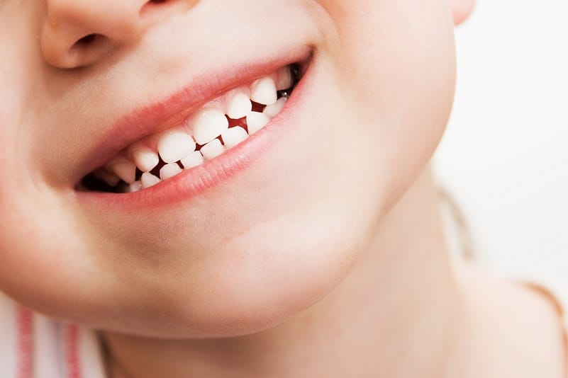 Growing child's smile
