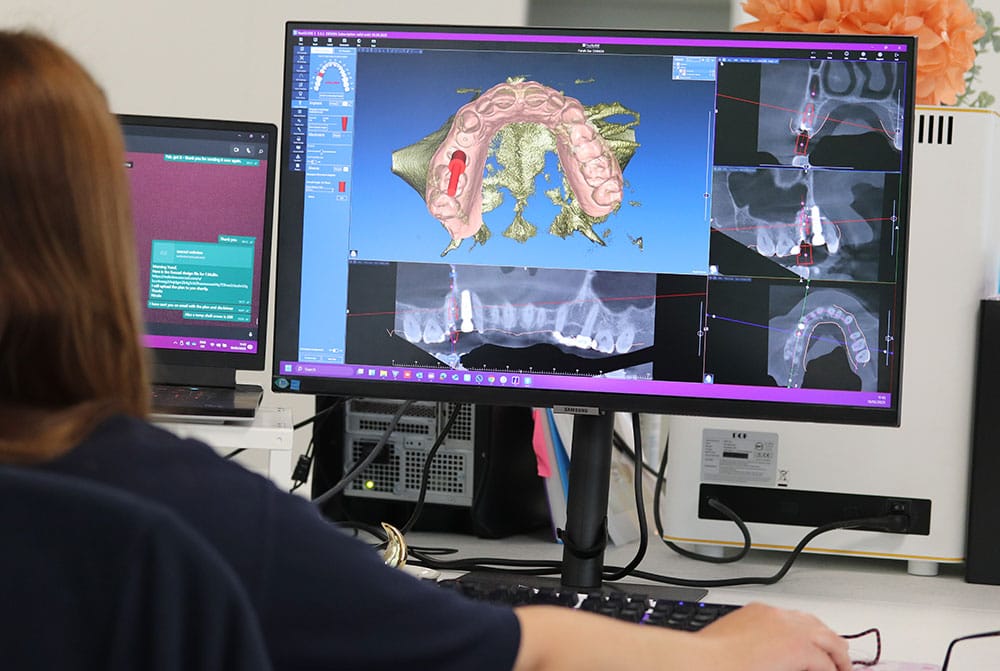 Dental CAD CAM crown planning