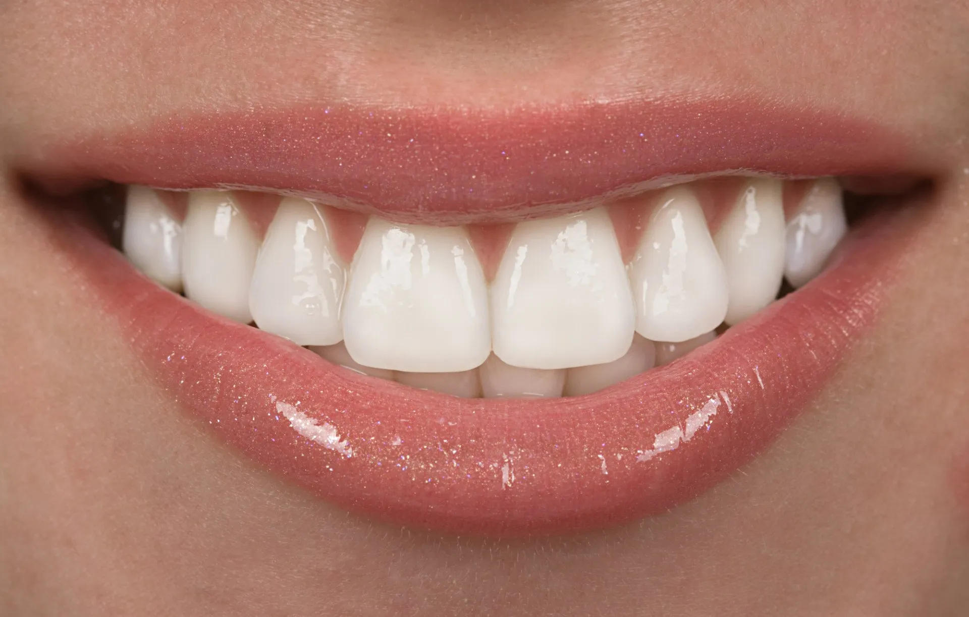 Composite veneers dental treatment