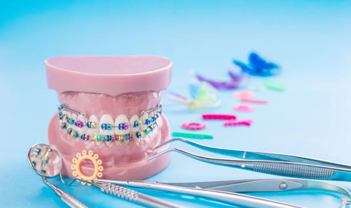 Orthodontic treatment
