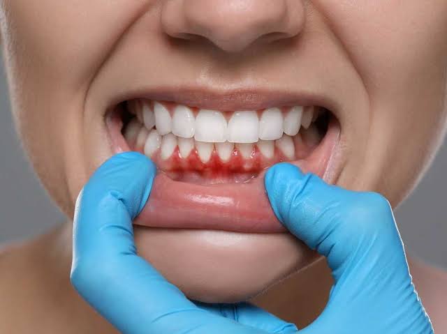 Gum Care & Periodontal Treatment