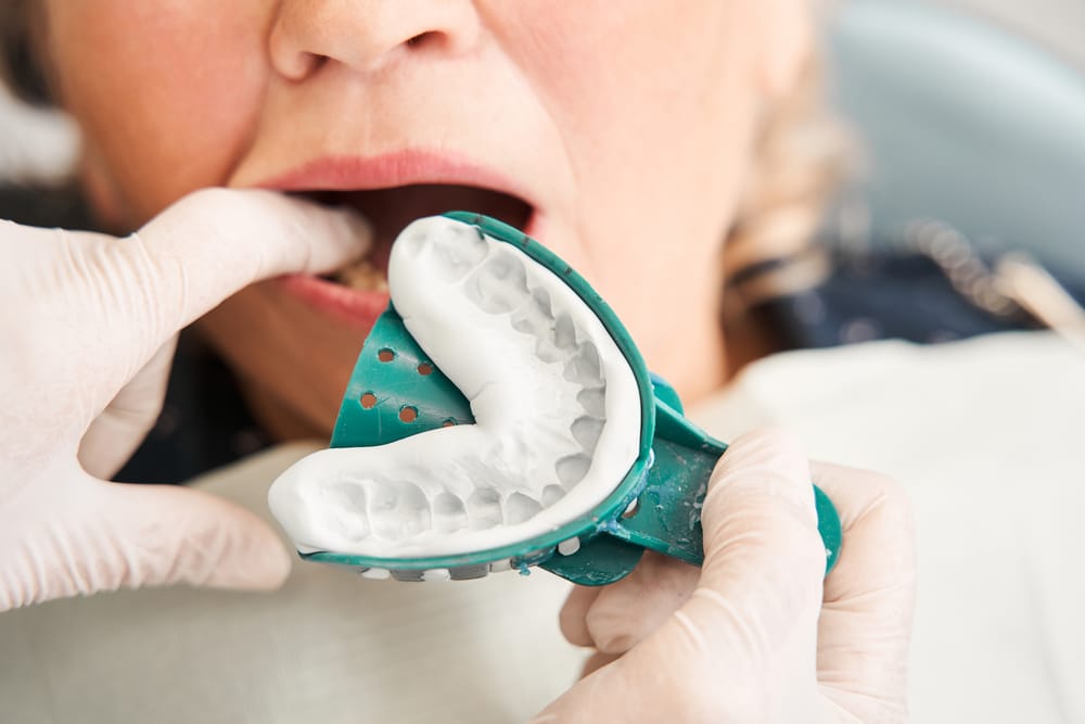 Dental impression for dentures