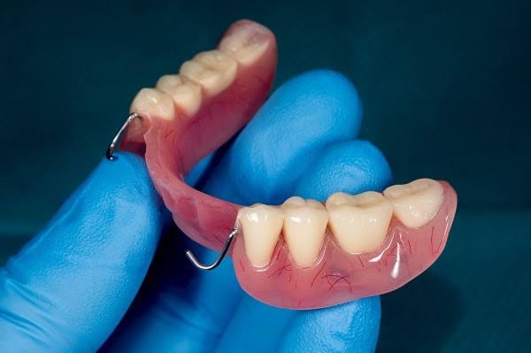 Partial dentures